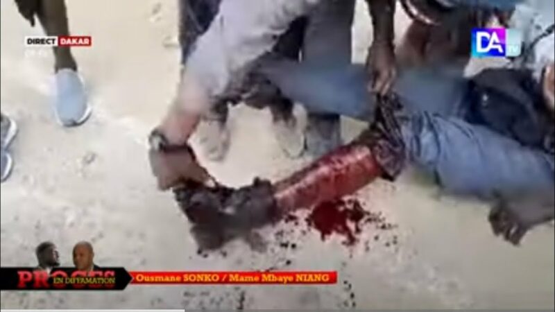 Rond-point Fenêtre Mermoz : Un garde du corps de Sonko blessé gravement à la jambe